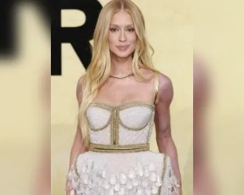 Marina Ruy Barbosa aparece com braço roxo e choca com explicação