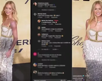 Marina Ruy Barbosa assusta fãs com ombro roxo, e explicação surpreende