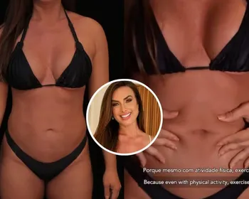 Nicole Bahls impressiona ao mostrar antes e depois de lipo HD