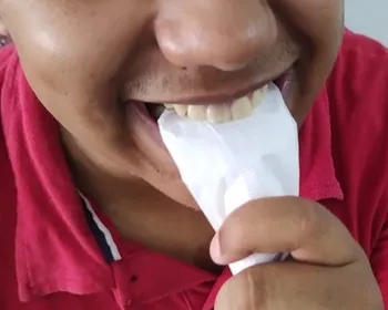 O que é síndrome de pica? Entenda a polêmica nas redes