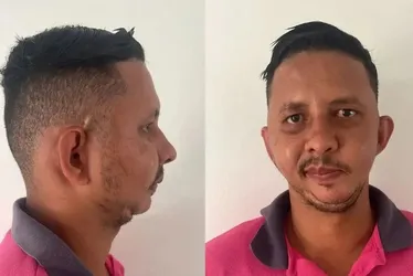 
			
				Homem alvo de piada de Carlinhos Maia espera há mais de 10 anos por cirurgia de R$ 471 mil
			
			