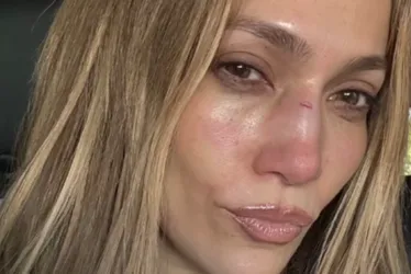 
			
				Jennifer Lopez sofre acidente em ensaio para premiação
			
			