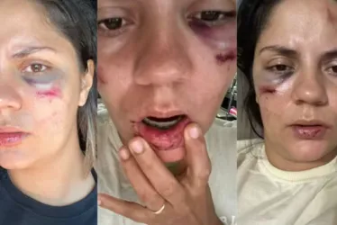 
			
				Mulher é arremessada de montanha-russa em parque aquático recém-inaugurado: ‘Desesperador’
			
			
