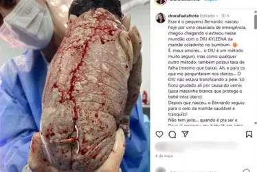 
			
				Mulher engravida com DIU e bebê nasce com dispositivo grudado nas costas no DF
			
			