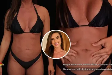 
			
				Nicole Bahls impressiona ao mostrar antes e depois de lipo HD
			
			