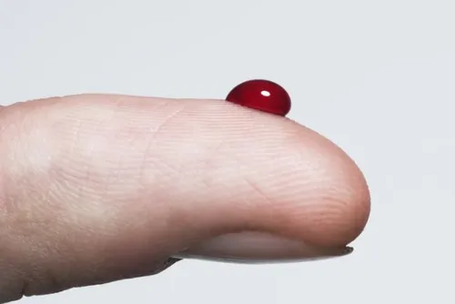 
				Diabetes: saiba quais são os sintomas de excesso de açúcar no sangue
			
			