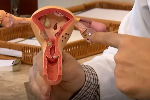 
				Endometriose: conheça os sintomas e saiba como tratar a doença
			
			