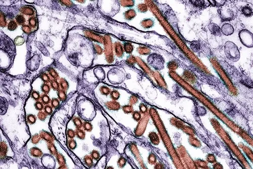 
				H5N1: México registra 1ª morte por gripe aviária na América Latina
			
			