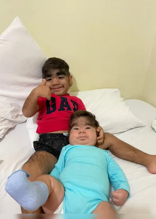 
			
				Influenciadora dá à luz segundo filho com "síndrome do lobisomem"
			
			