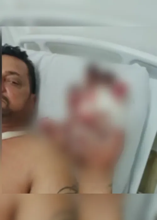 
			
				Pintor perde dedos da mão após bomba explodir em casa de ex-PM
			
			