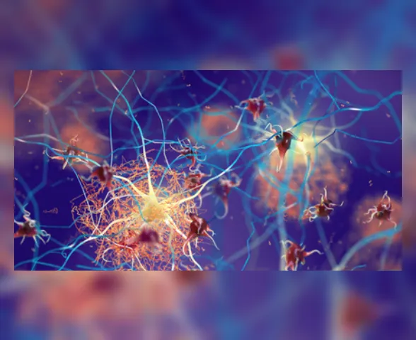 Conheça os prós e contras do novo medicamento para tratar casos de Alzheimer