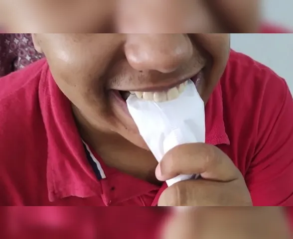 O que é síndrome de pica? Entenda a polêmica nas redes