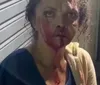 Delegado destaca gravidade da agressão em Quebrangulo e investiga suspeito imagem