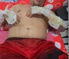 Motorista de app queimado vivo fala pela primeira vez e pede ajuda: “Tou vivo por um milagre” imagem