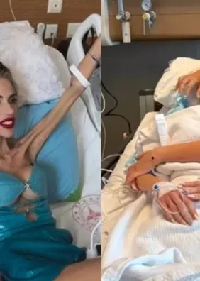 Influencer que morreu com 22 kg desenvolveu anorexia após prisão