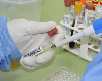 AL registra sete casos de meningite em 2024; Sesau reforça alerta para vacinação