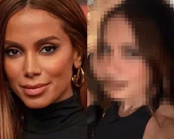 Anitta choca ao reaparecer na web com novo rosto: “Mexeu em tudo”