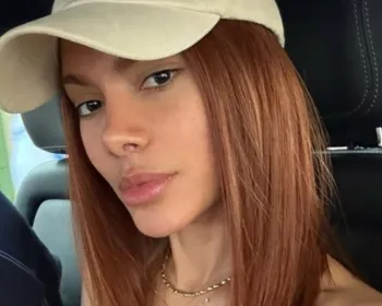 Anitta explica como procedimentos no rosto afetaram novo projeto
