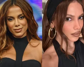Anitta fala sobre mudança no rosto e rumores de cirurgia malsucedida