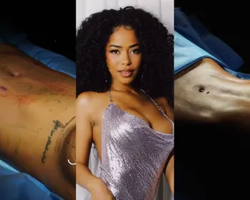 Após dar à luz, Lorena Maria passa por cirurgias e gasta R$ 160 mil