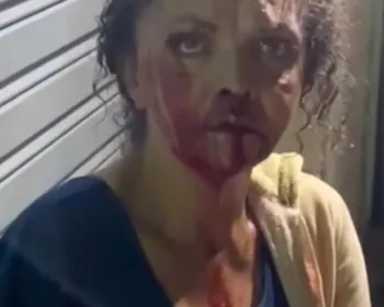 Delegado destaca gravidade da agressão em Quebrangulo e investiga suspeito