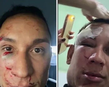 Dentista é espancado em camarote na Bahia: “Vieram com sede de sangue”