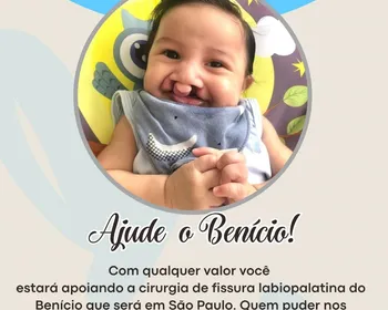 Família faz campanha para custear cirurgia de bebê com fissura labiopalatina