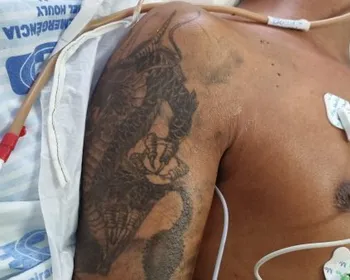 Hospital de Arapiraca busca familiares de paciente agredido internado na UTI