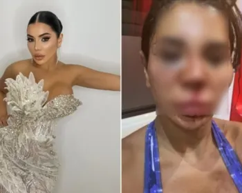 Influencer é torturada por horas e tem rosto desfigurado em assalto