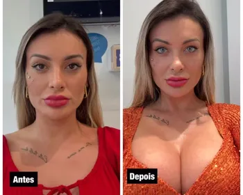 'Medo de ficar cega', diz Urach após mudar cor dos olhos