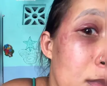Tapas, socos, mata-leão: veja o relato de mulher agredida pelo marido