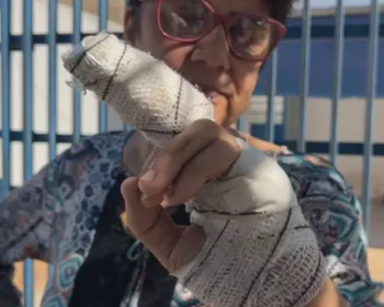 Mulher tem parte do dedo decepado após ataque de pitbull