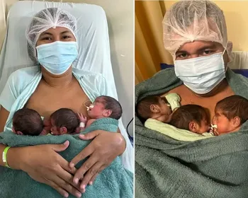 Quando o ultrassom erra a conta: mãe descobre trigêmeos na hora do parto