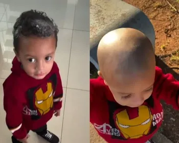 Vídeo: criança usa creme depilatório na cabeça e perde o cabelo