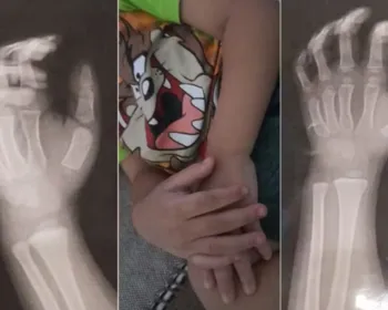 Vídeo mostra agressão de professora contra aluno de três anos no litoral