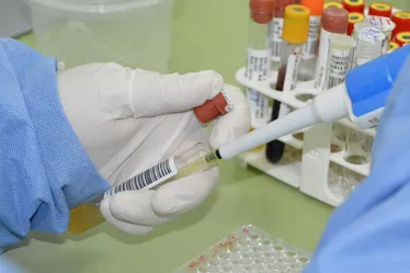 
				AL registra sete casos de meningite em 2024; Sesau reforça alerta para vacinação
			
			