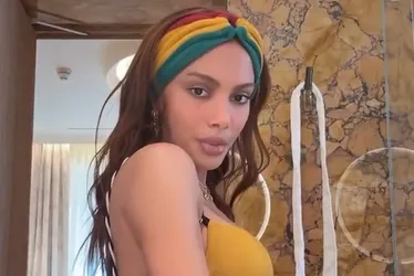 
				Anitta choca ao reaparecer na web com novo rosto: “Mexeu em tudo”
			
			
