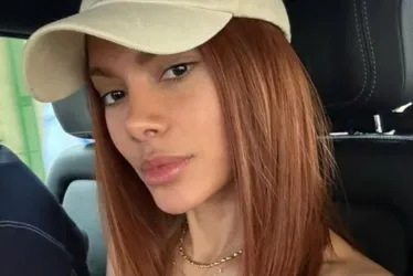 
				Anitta explica como procedimentos no rosto afetaram novo projeto
			
			