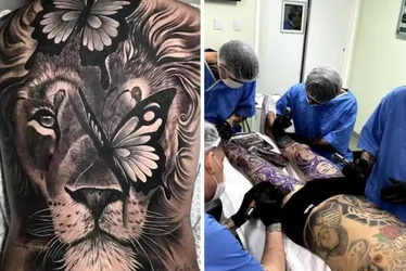 
				Conselho proíbe uso de anestesia geral e sedação para tatuagem
			
			