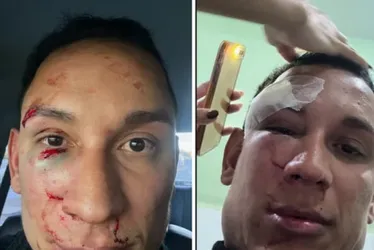
				Dentista é espancado em camarote na Bahia: “Vieram com sede de sangue”
			
			
