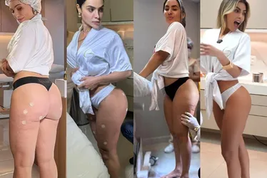 
			
				Famosas mostram o antes e depois após tratamento para celulite; compare!
			
			