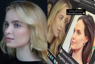 
				Giovanna Chaves faz harmonização facial para ficar parecida com Angelina Jolie
			
			