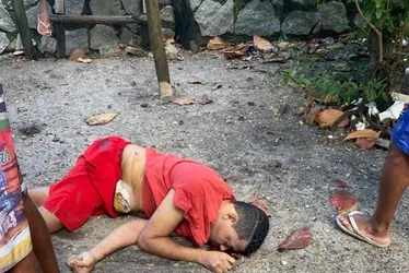 
			
				Homem com bolsa de colostomia é assassinado a tiros no Vergel
			
			