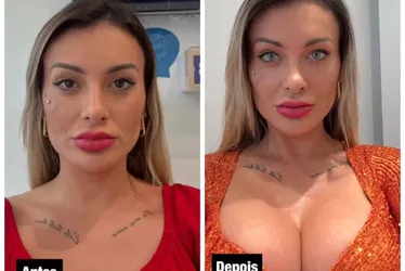 
				'Medo de ficar cega', diz Urach após mudar cor dos olhos
			
			