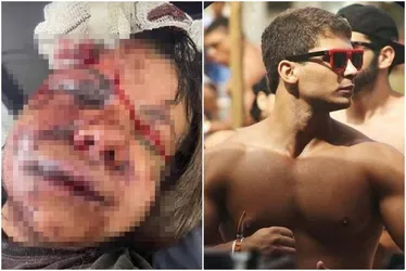 
				Mulher espancada com 60 socos pelo ex: “Ele disse que iria me matar”
			
			