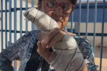 
			
				Mulher tem parte do dedo decepado após ataque de pitbull
			
			