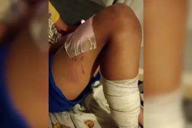 
			
				Pit-bull deixa três crianças feridas em condomínio no interior
			
			