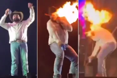 
			
				Sertanejo Léo mostra como ficou seu rosto após ser queimado em show
			
			