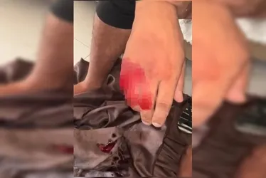 
				Tribunal do crime: ladrão tem dedo cortado por faccionado
			
			