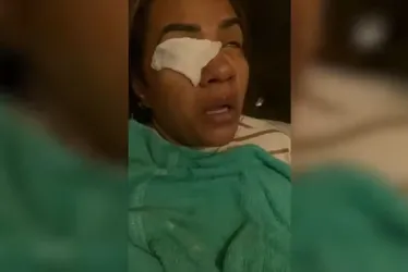 
				VÍDEO: Mulher diz ter ficado cega após usar produto da influenciadora Virginia Fonseca
			
			